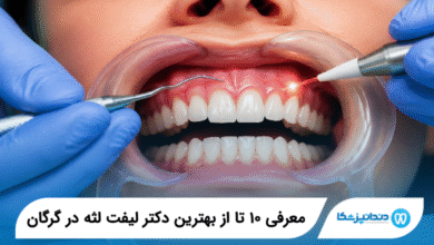 بهترین دکتر لیفت لثه در گرگان