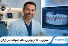 بهترین دکتر ایمپلنت در گرگان
