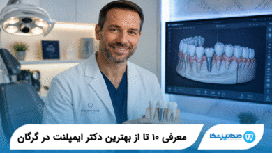 بهترین دکتر ایمپلنت در گرگان