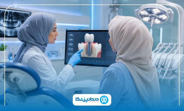 بهترین سن برای انجام ایمپلنت دندان