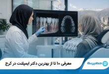 بهترین دکتر ایمپلنت در کرج