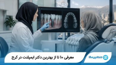 بهترین دکتر ایمپلنت در کرج