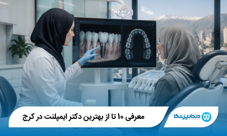 بهترین دکتر ایمپلنت در کرج