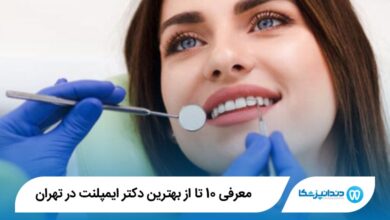 بهترین دکتر ایمپلنت در تهران