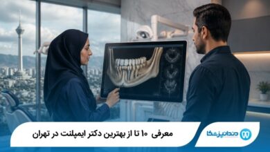 بهترین دکتر ایمپلنت در تهران