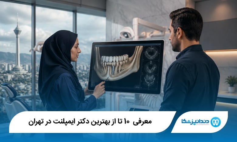 بهترین دکتر ایمپلنت در تهران