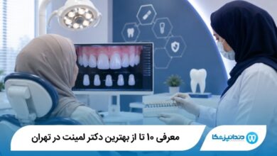 بهترین دکتر لمینت در تهران