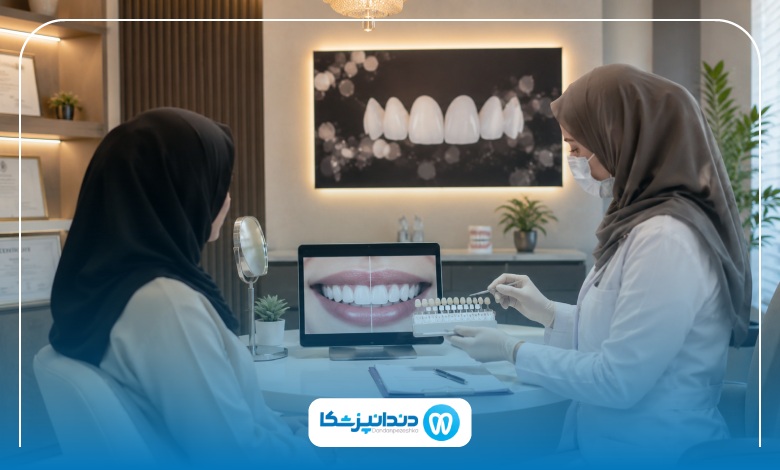 مراحل انجام لمینت دندان در تهران