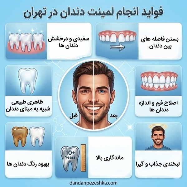 فواید انجام لمینت دندان در تهران