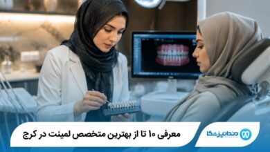 بهترین متخصص لمینت در کرج