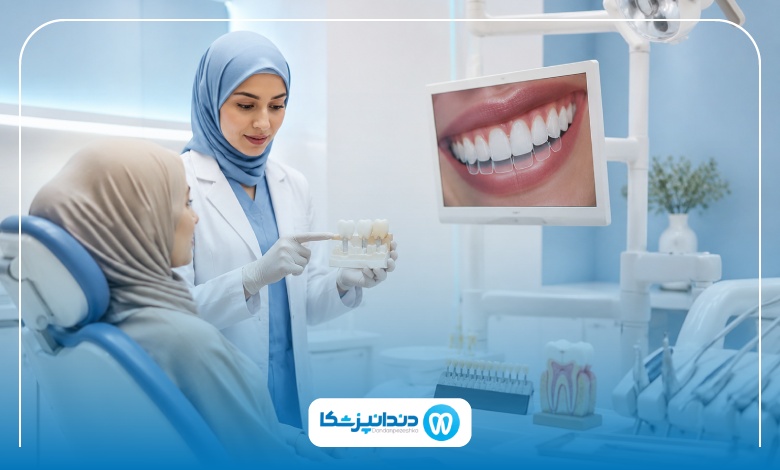 بهترین برندهای لمینت دندان کدام است؟
