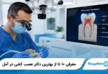 بهترین دکتر عصب‌ کشی در آمل