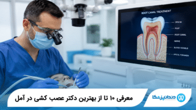 بهترین دکتر عصب‌ کشی در آمل