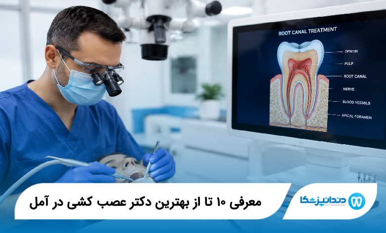 بهترین دکتر عصب کشی در آمل