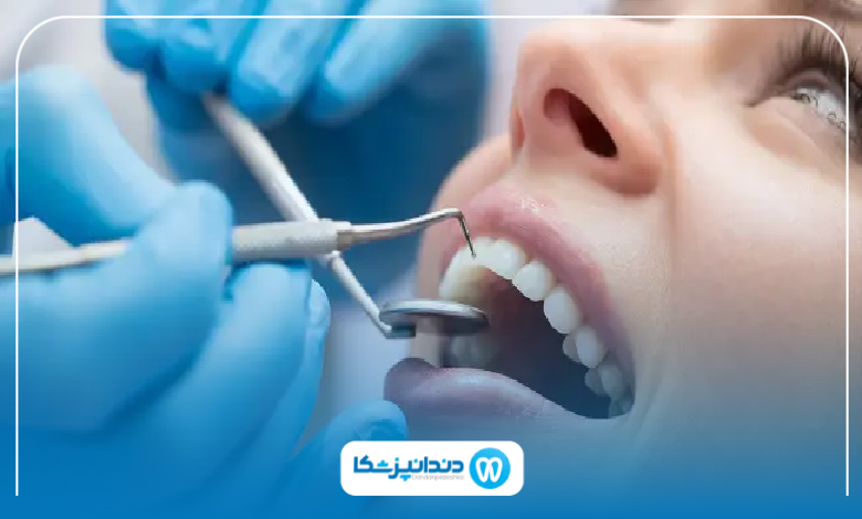 بهترین دکتر عصب کشی در آمل
