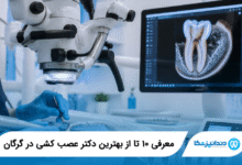 بهترین دکتر عصب کشی در گرگان