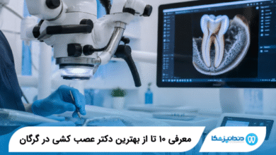 بهترین دکتر عصب کشی در گرگان