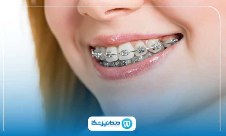 بهترین دکتر ارتودنسی در کرمان