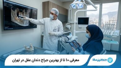 بهترین جراح دندان عقل در تهران