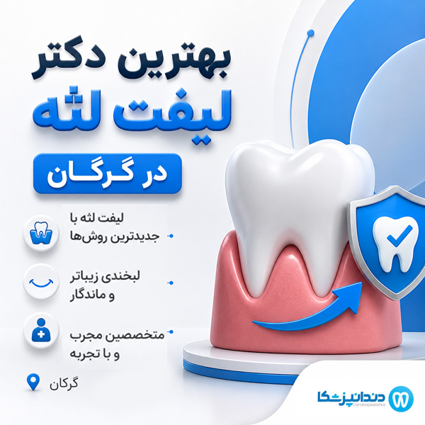 دکتر لیفت لثه در گرگان