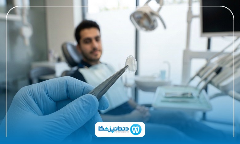 مراحل کامپوزیت دندان در سنندج