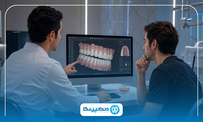 مقایسه بلیچینگ و لمینت در سنندج