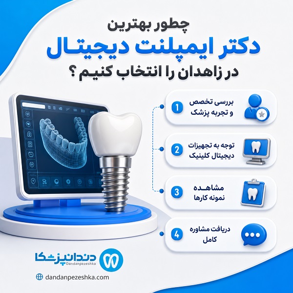 معرفی 10 تا از بهترین دکتر ایمپلنت دیجیتال در زاهدان