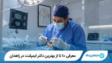 معرفی 10 تا از بهترین دکتر ایمپلنت در زاهدان