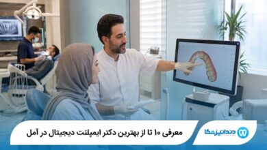 معرفی 10 تا از بهترین دکتر ایمپلنت دیجیتال در آمل 【سال1405】⭐