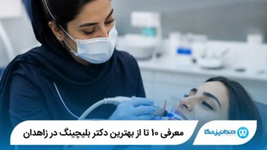 معرفی 10 تا از بهترین دکتر بلیچینگ در زاهدان