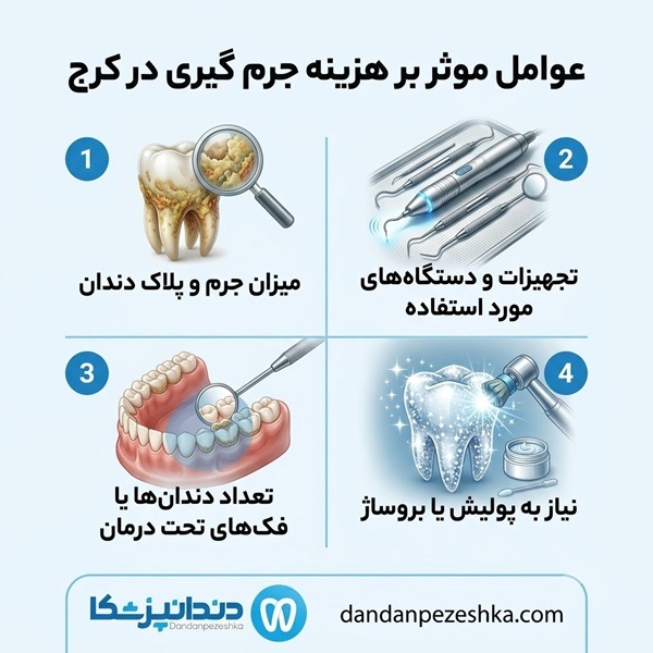 عوامل موثر بر هزینه جرم گیری در کرج