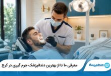 بهترین دندانپزشک جرم گیری در کرج