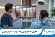 بهترین دکتر ایمپلنت در کیانپارس