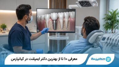 بهترین دکتر ایمپلنت در کیانپارس