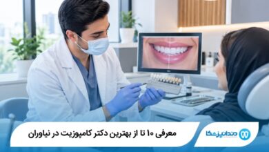 بهترین دکتر کامپوزیت در نیاوران