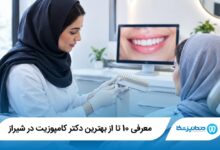 بهترین دکتر کامپوزیت در شیراز