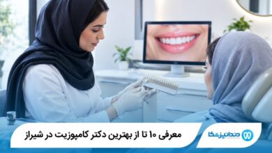 بهترین دکتر کامپوزیت در شیراز