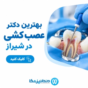 بهترین دکتر عصب کشی در شیراز