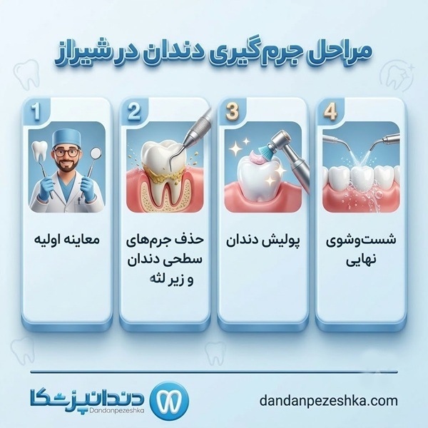 مراحل جرم گیری دندان در شیراز