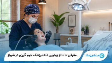 بهترین دندانپزشک جرم گیری در شیراز
