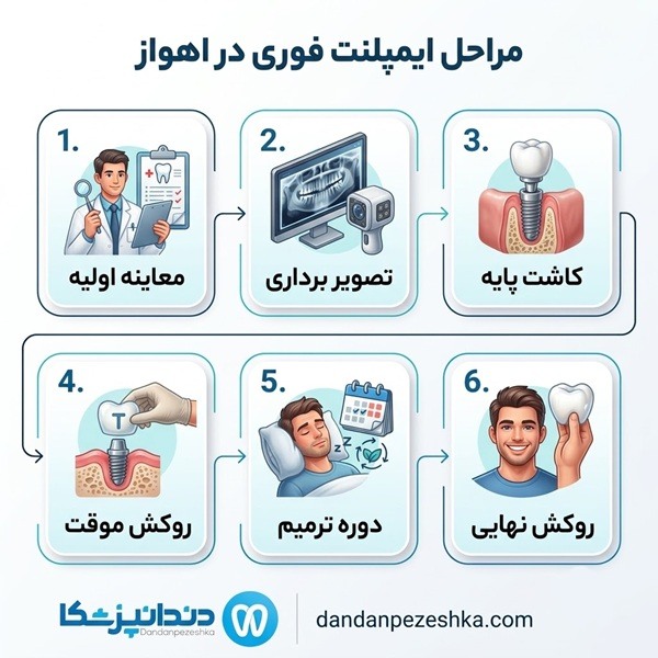 مراحل ایمپلنت فوری در اهواز