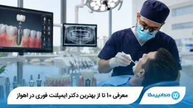 بهترین دکتر ایمپلنت فوری در اهواز