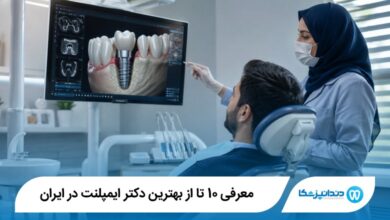 بهترین دکتر ایمپلنت در ایران