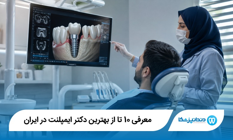 بهترین دکتر ایمپلنت در ایران
