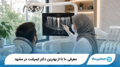 بهترین دکتر ایمپلنت در مشهد