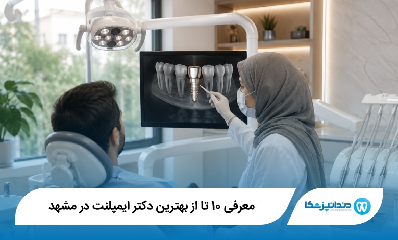 بهترین دکتر ایمپلنت در مشهد