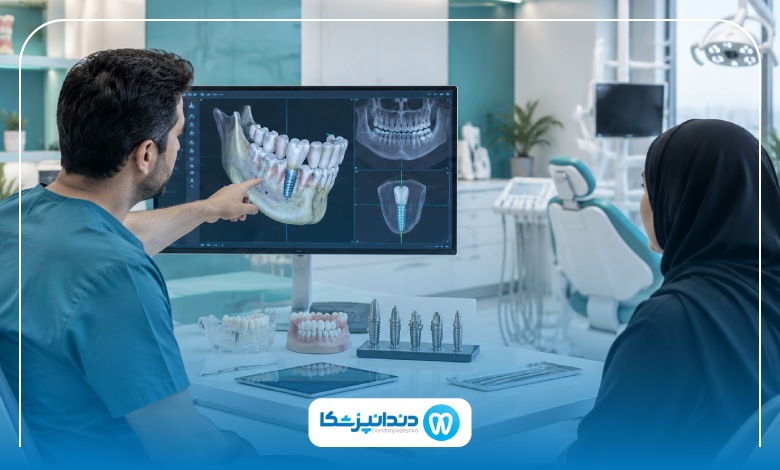 ایمپلنت پانچ چیست و مناسب چه کسانی است؟