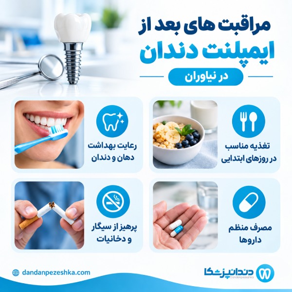 مراقبت های بعد از ایمپلنت دندان در نیاوران