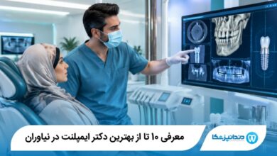 بهترین دکتر ایمپلنت در نیاوران
