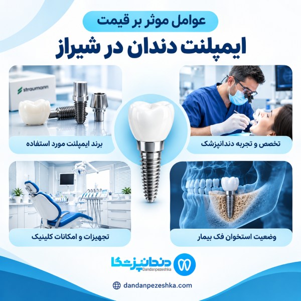 عوامل موثر بر قیمت ایمپلنت دندان در شیراز